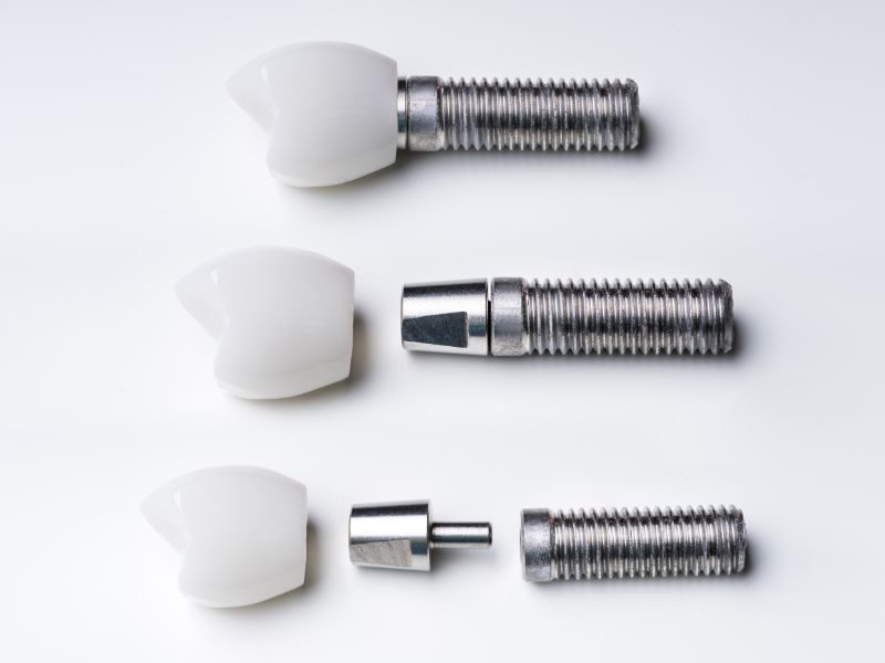 Dental Implants