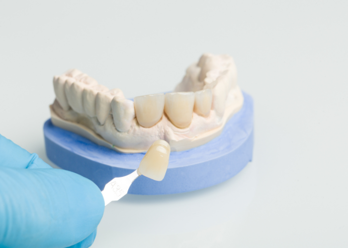 dental crown Orem Utah