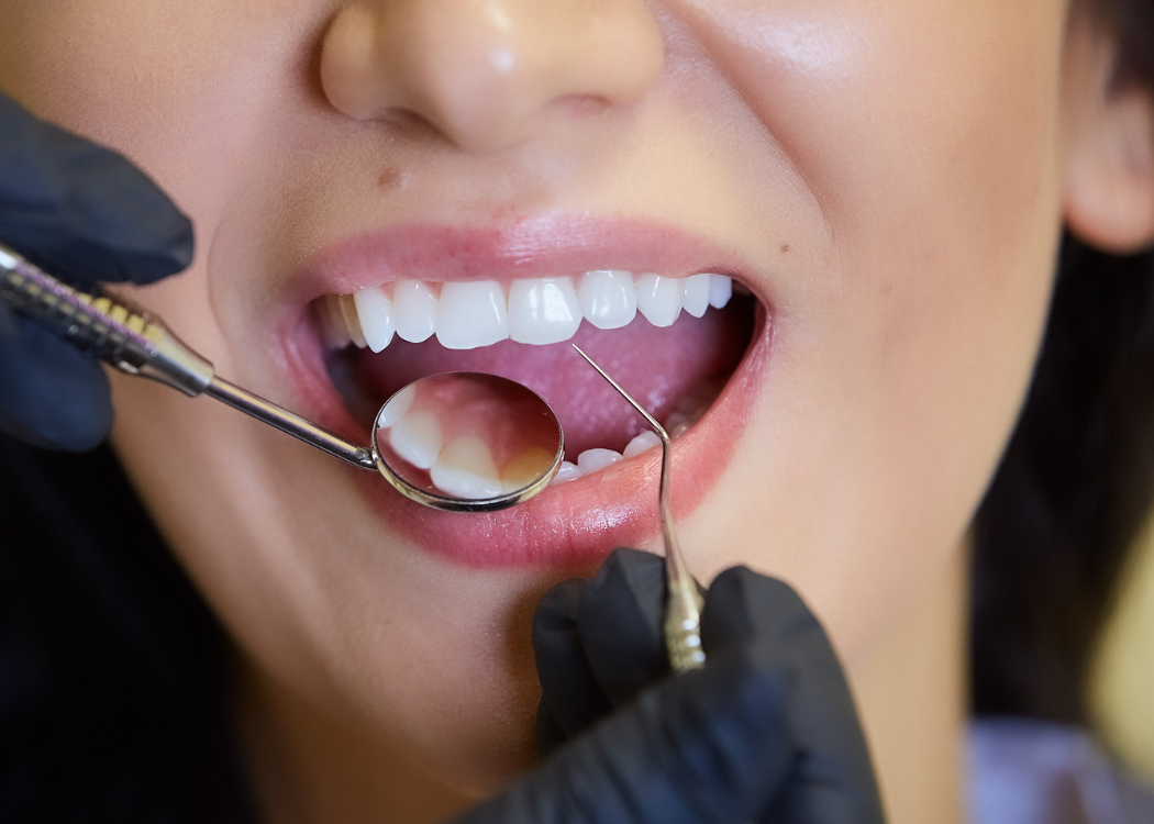 Oral surgery Orem Utah