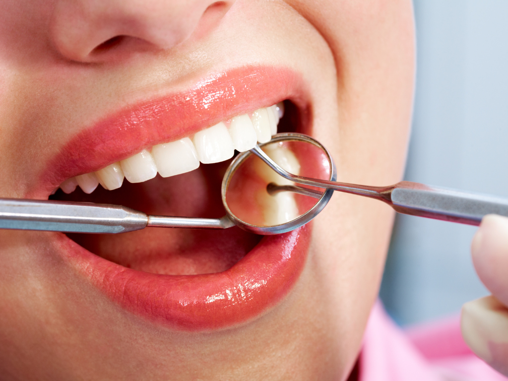dental sealant Orem Utah